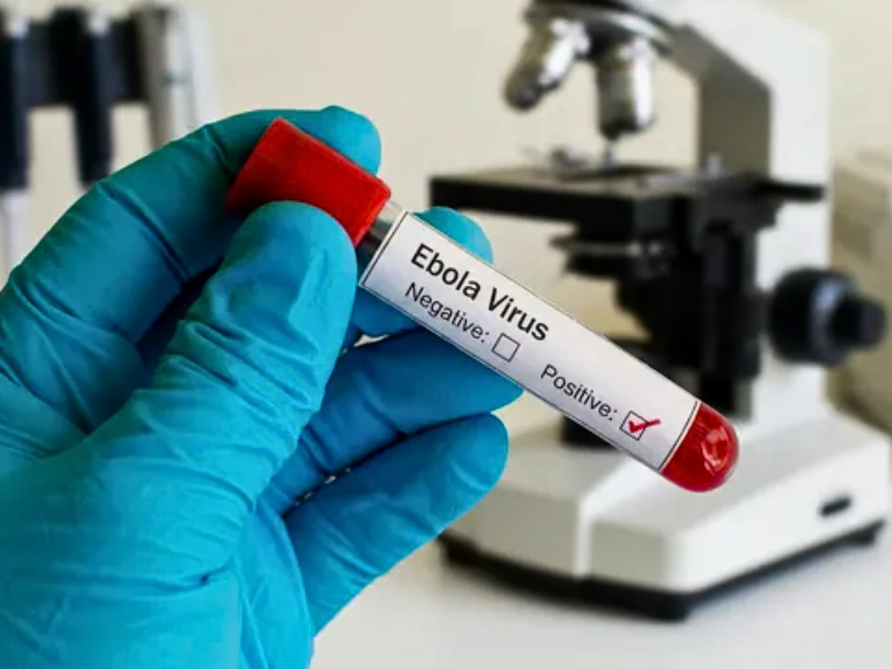 The image represent the ebola bundibugyo virus testing cube
